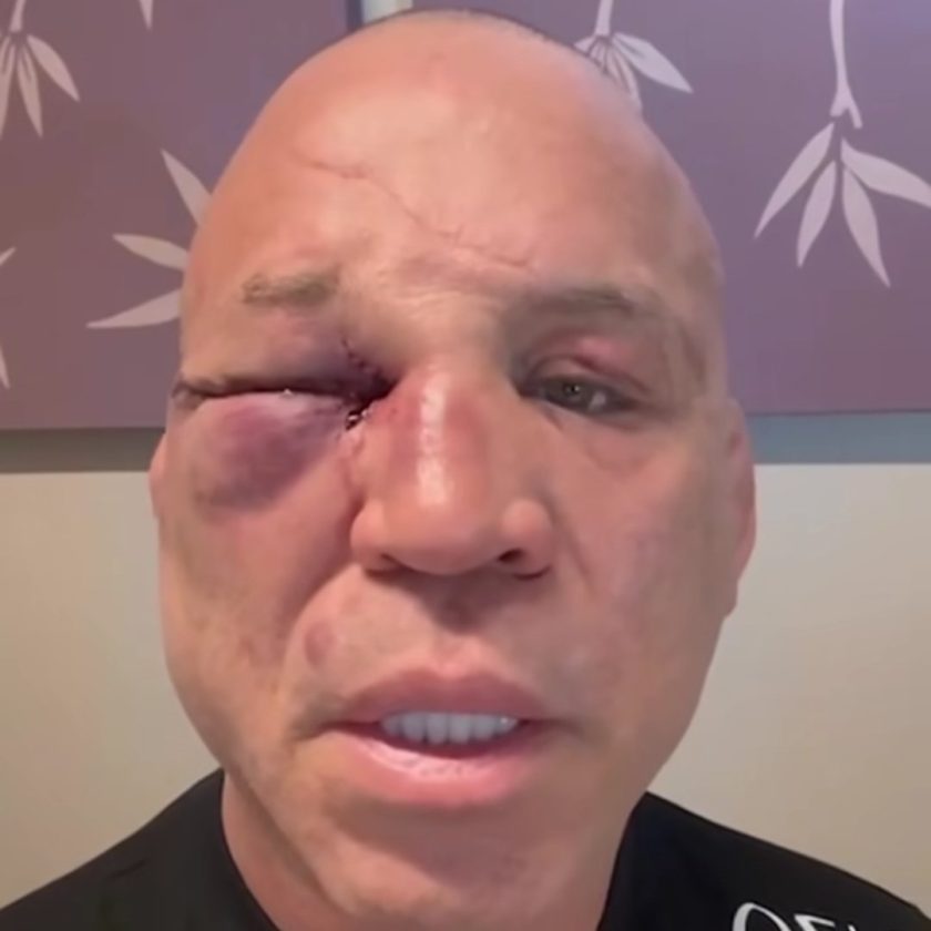 Wanderlei Silva - Foto: reprodução das redes sociais