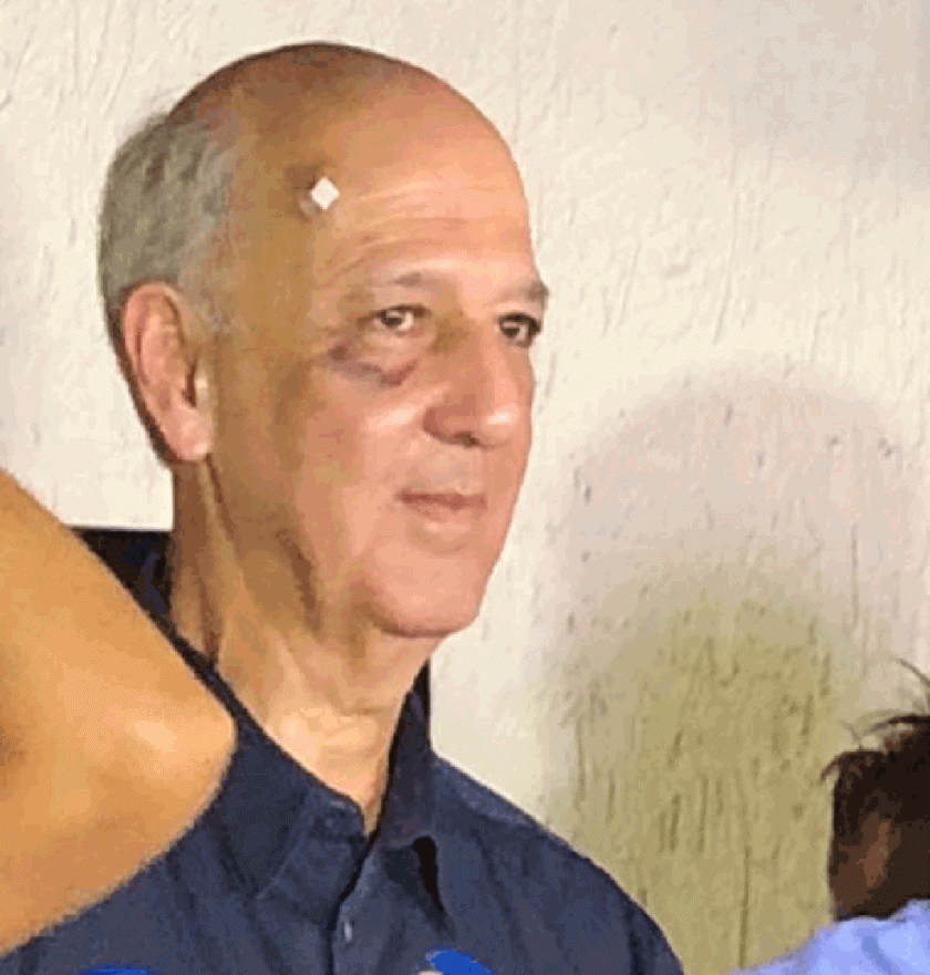 arruda (1) arruda (1)